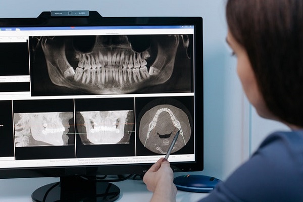 dental-worker-looking-at-teeth-xray